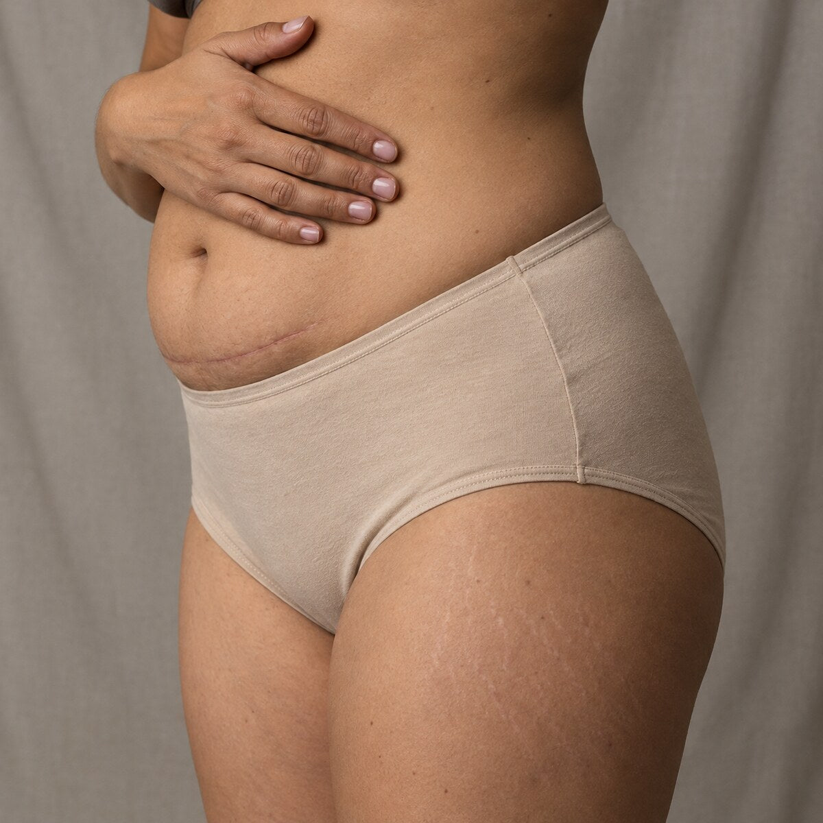 Primer plano del vientre tras una cesárea, con la cicatriz y el pliegue sobre ella